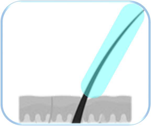 Hydra - hydratace a výživa